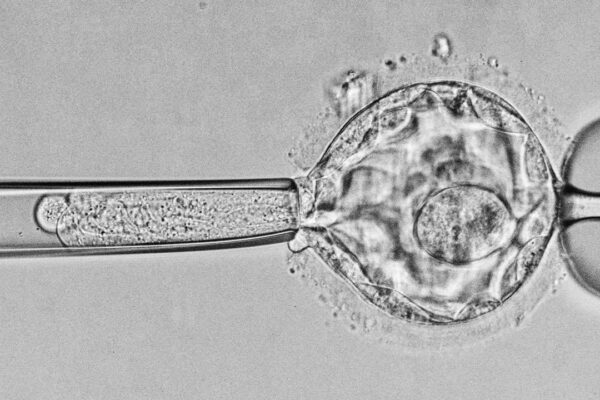 ca_1025nid_ivf_embryo_online